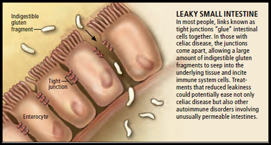 Diagram from www.trulyglutenfree.co.uk